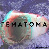 EMATOMA