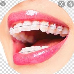 Orthodontique | Dentisterie