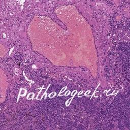 Pathologeek