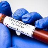 Coronavirus en ligne | COVID 19